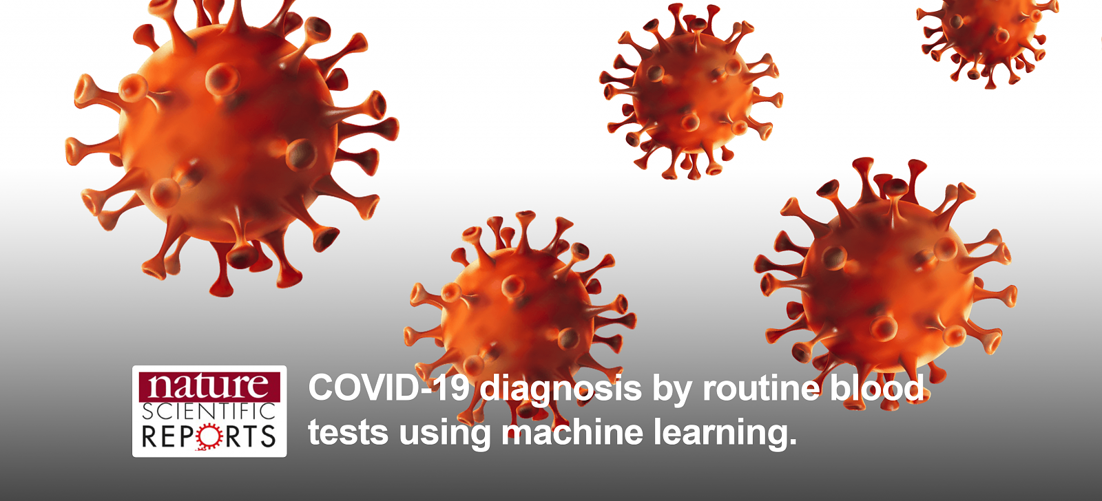 COVID-19 diagnosis by routine blood tests using machine learning